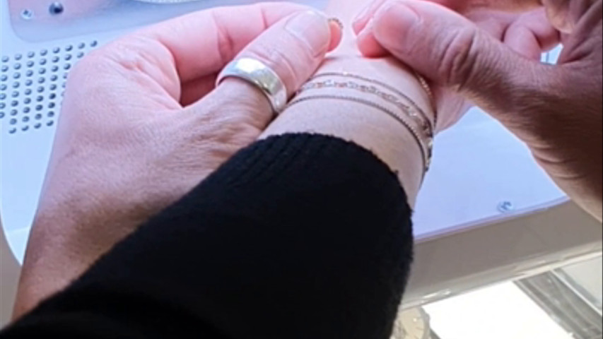 Bracciale saldato al polso 3