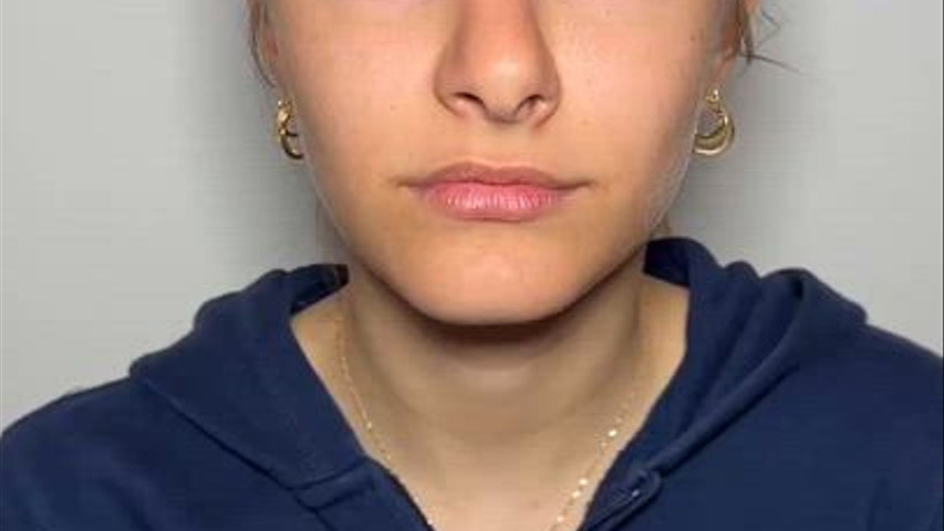 Prima e dopo 